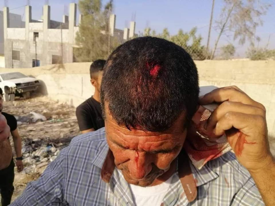 Des colons israéliens blessent un Palestinien près de Naplouse
