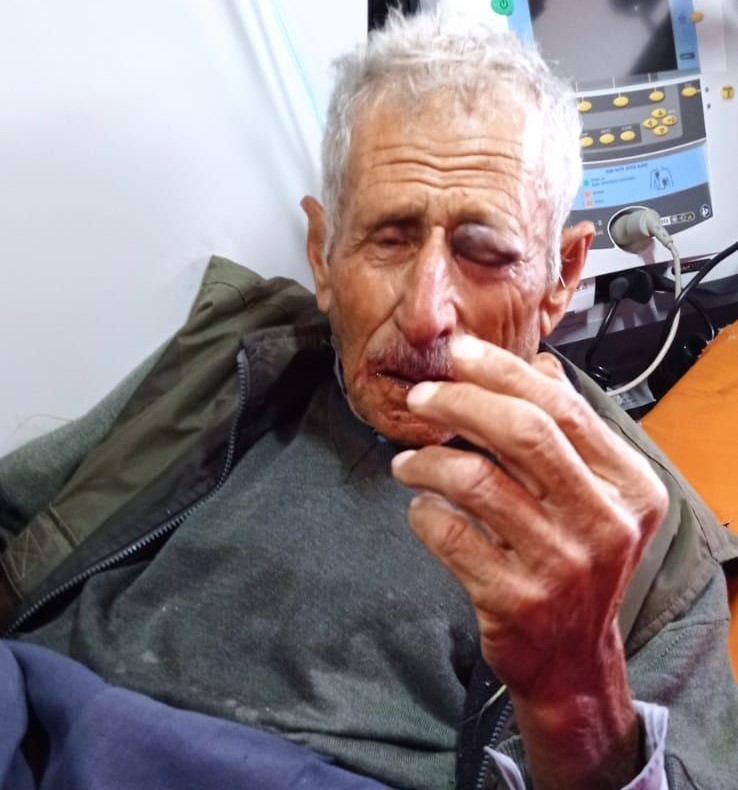 Des colons juifs agressent sauvagement un vieil homme près de Tulkarm