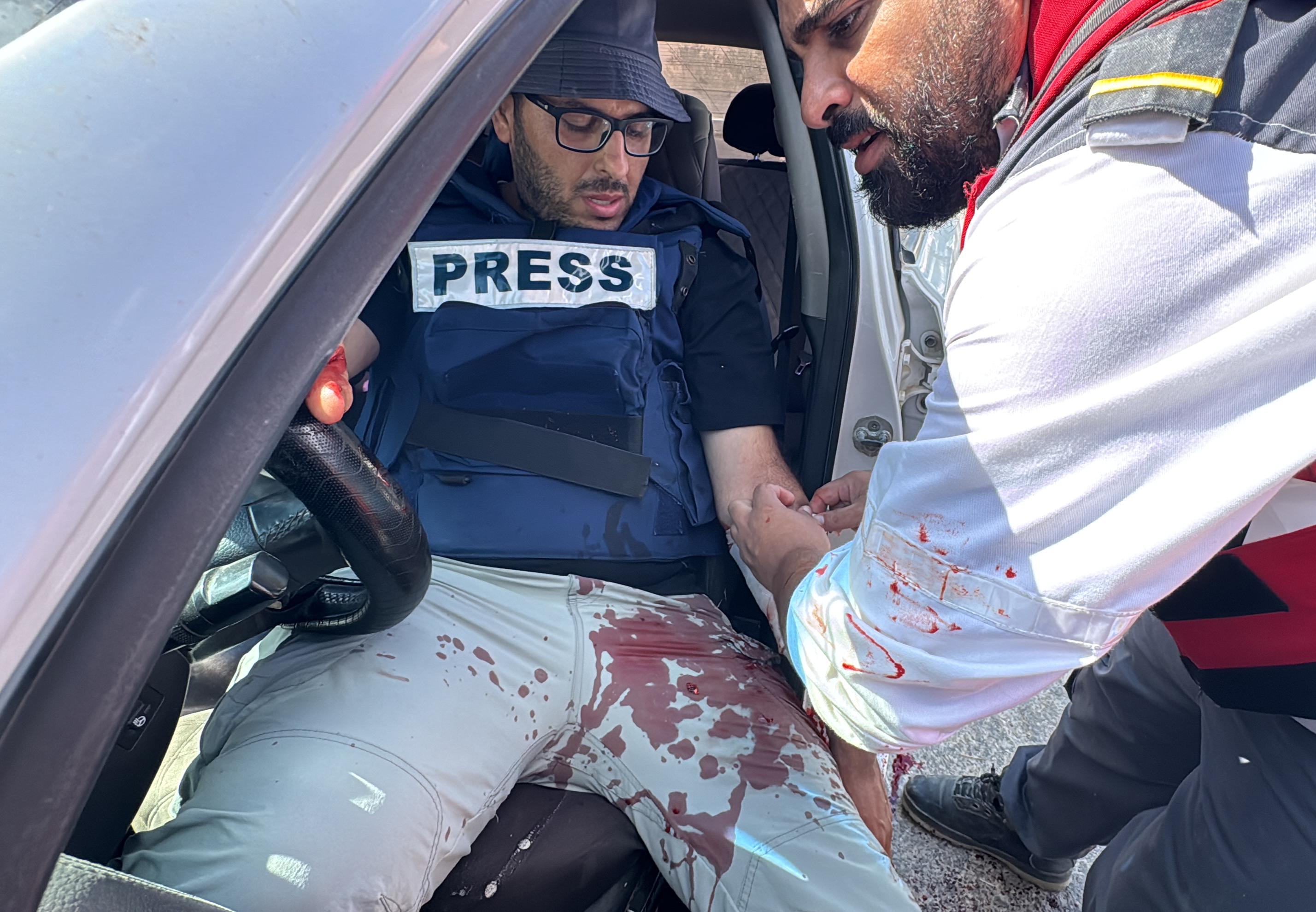(Mise à Jour) Jénine : les forces de l’occupation blessent quatre journalistes, dont deux de WAFA  