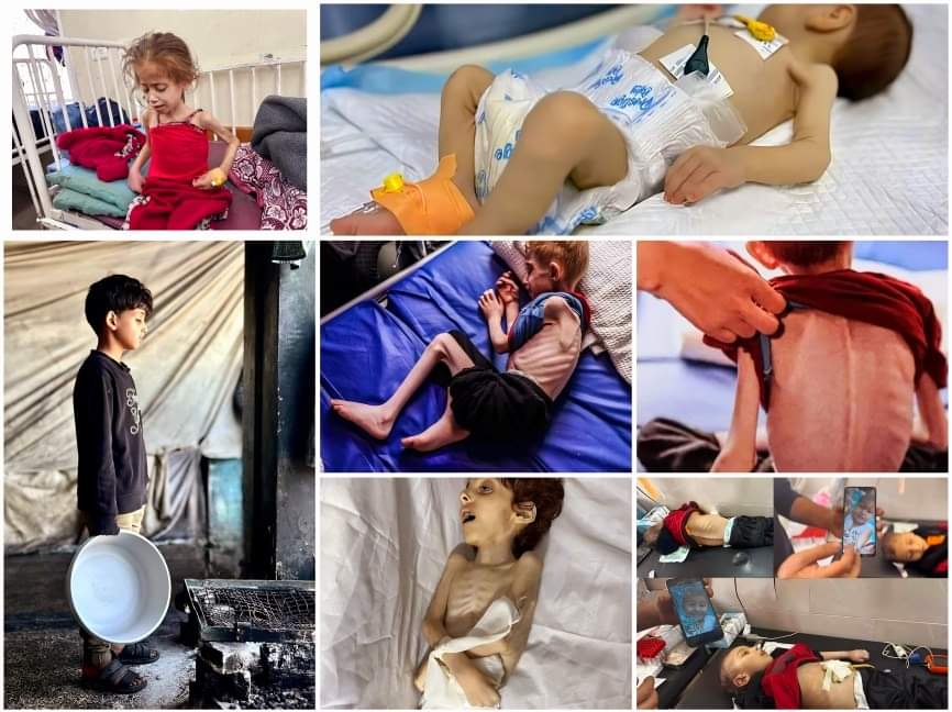 L'ONU met en garde contre une famine catastrophique pour 345 000 Palestiniens à Gaza cet hiver