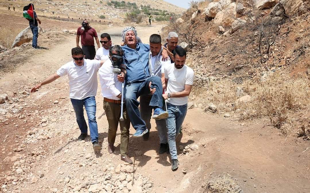 15 Palestiniens blessés par les forces d'occupation à Beita, Kafr Qaddoum