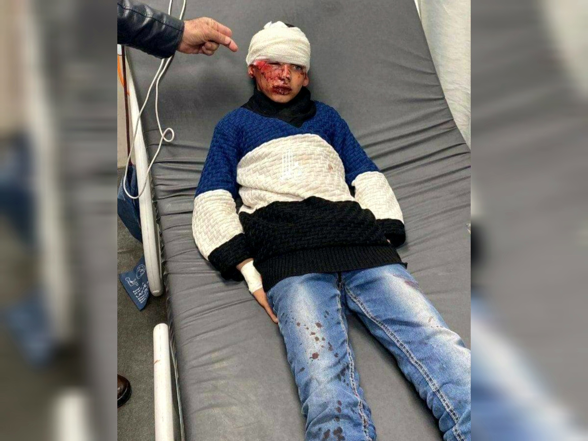 Un enfant blessé dans une attaque des colons israeliens à l'est d'Hébron