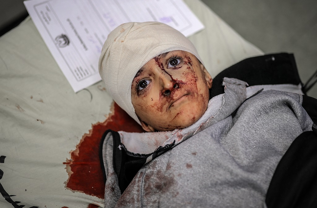 Martyrs et blessés lors des raids aériens et d'artillerie de l'occupation sur la bande de Gaza