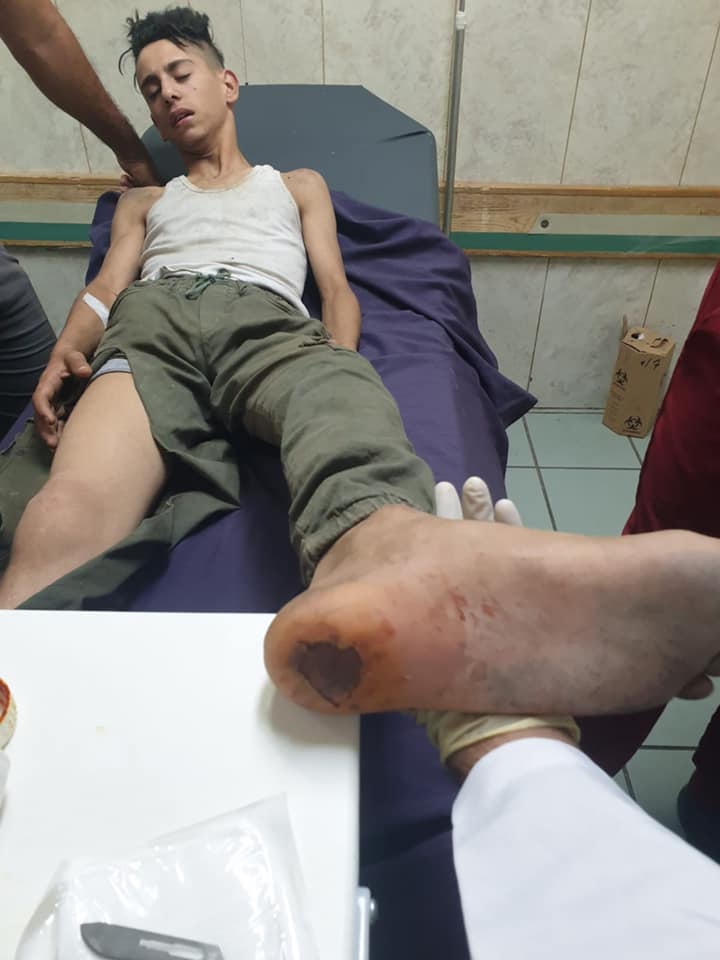 Des colons israéliens battent sauvagement un enfant palestinien à Jénine