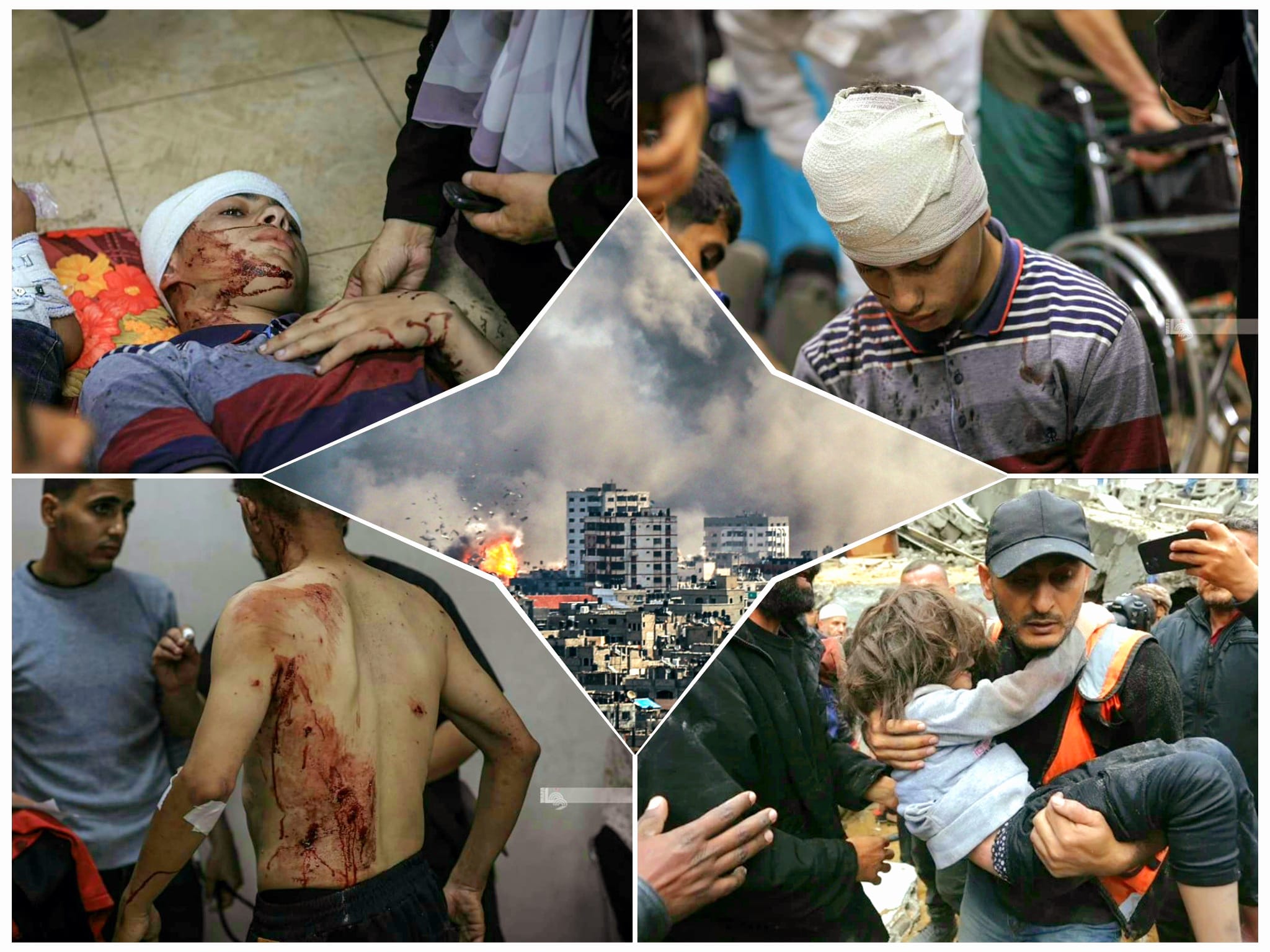 Au 193ème jour de l'agression : martyrs et blessés dans les bombardements d'occupation en cours dans la bande de Gaza