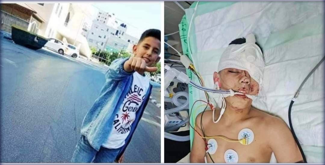 Un enfant et un jeune succombent à leurs blessures subies en Cisjordanie