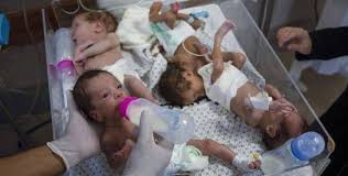 4 enfants décèdent des suites de déshydratation et de malnutrition à l'hôpital Kamal Adwan, dans le nord de Gaza.