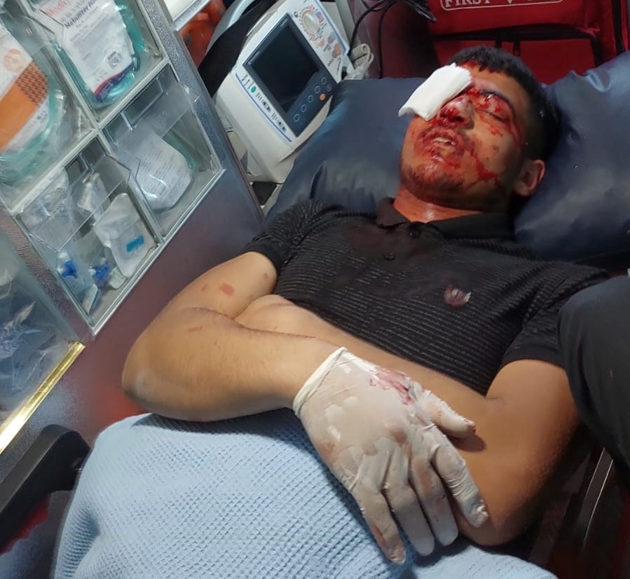 Des Blessés par balles et des suffocations lors d'affrontements avec l'occupation au nord de la Cisjordanie occupée