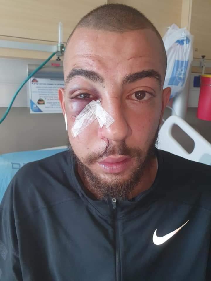 Les forces de l’occupation agressent sauvagement un jeune palestinien  