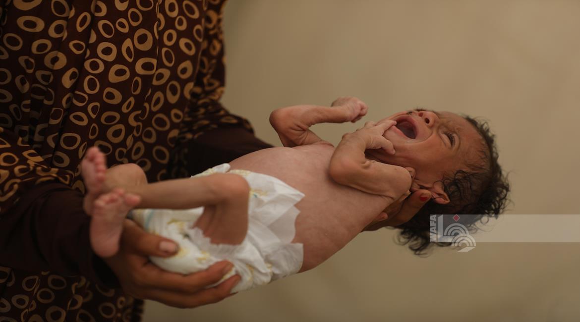 5 décès dus à la famine et à la malnutrition au cours des dernières 24 heures