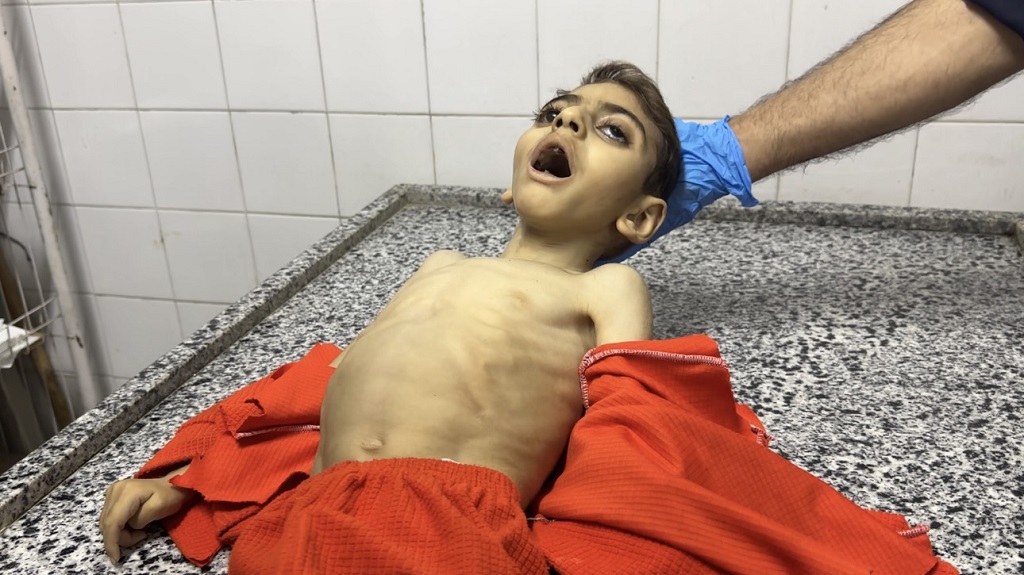 L'anfant Mohammed Mustafa Yassin, âgé de 4 ans