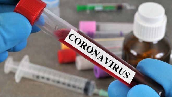 33 décès et 2182 nouveaux cas de Coronavirus en Palestine