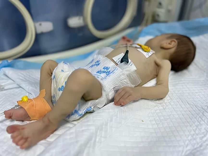 La famine décède quatre Palestiniens dont deux enfants à Gaza, portant le total à 34