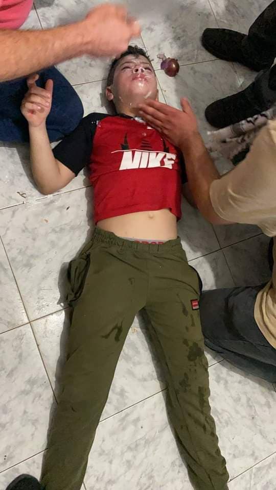 Blessures lors d’une attaque par les forces d'occupation d’un rassemblement au nord de Jérusalem