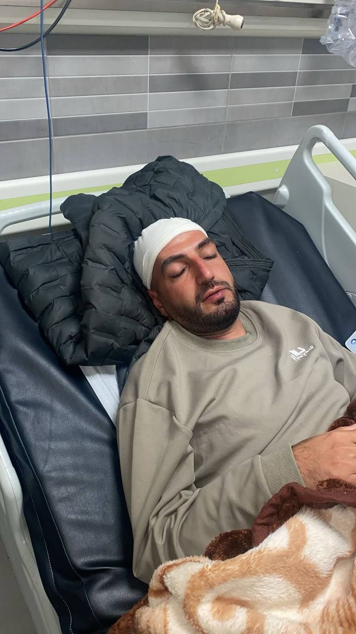 Un Palestinien de Jérusalem blessé après avoir été la cible d'une bombe à gaz israélienne
