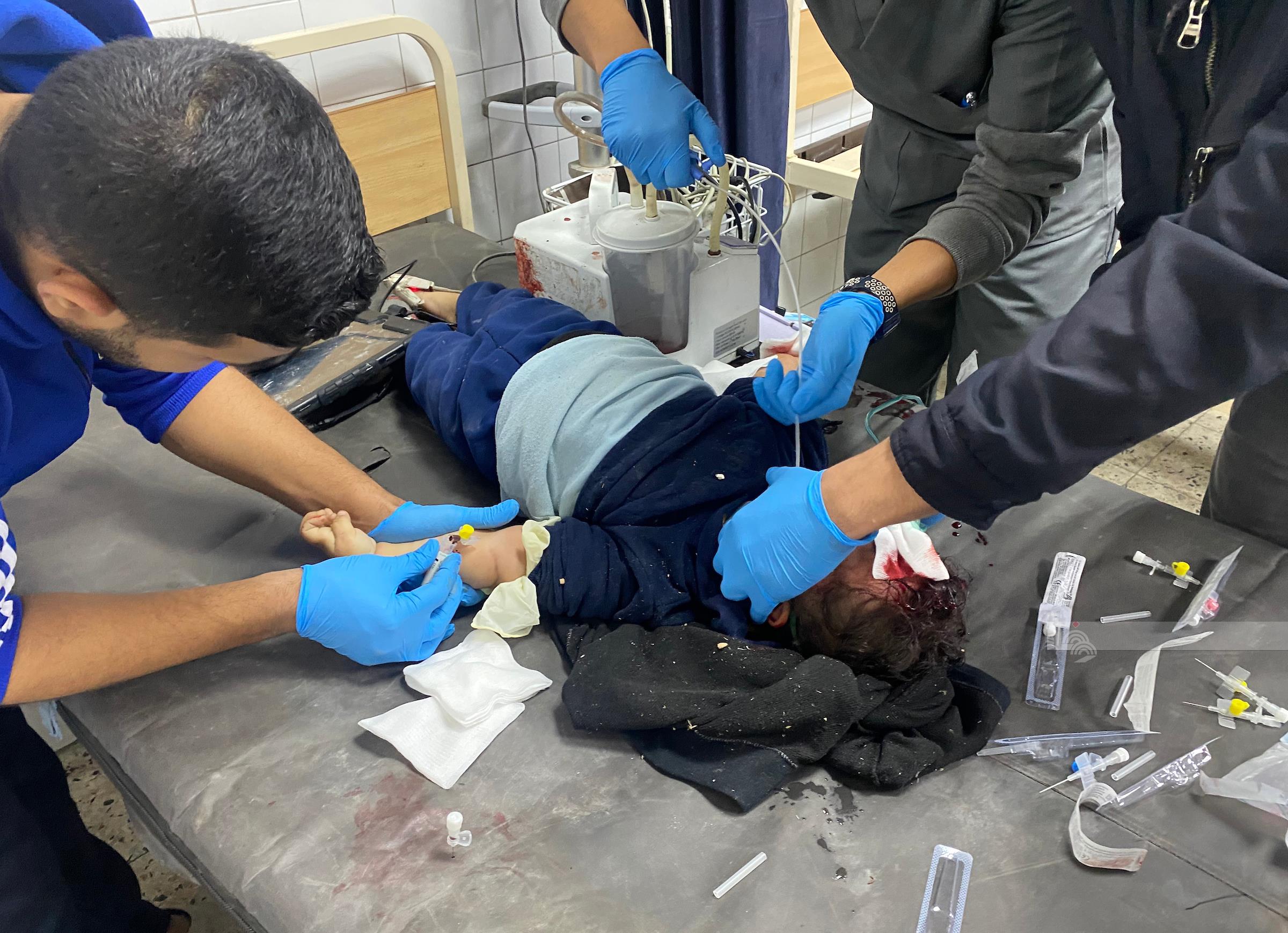 Deux pertes de vie dans un bombardement israélien visant l'hôpital Kamal Adwan