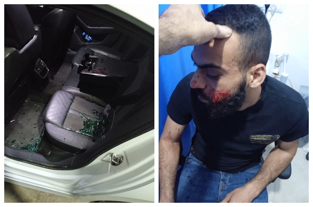Un chauffeur palestinien blessé dans une attaque des colons israéliens près de Ramallah