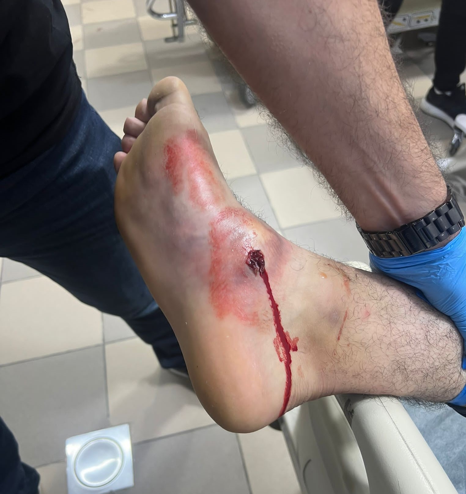 Un jeune palestinien blessé par balles de l’occupation près de Jérusalem 