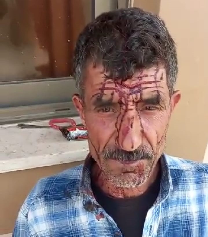 Des colons agressent et blessent un berger palestinien à Jénine