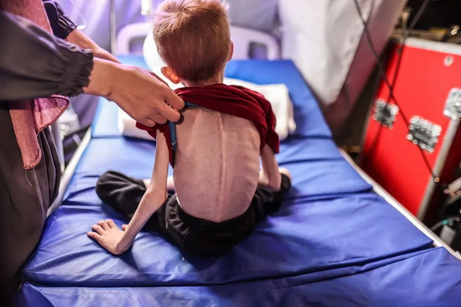 L'UNICEF ferme 21 centres de traitement de la malnutrition à Gaza en raison des attaques israéliennes