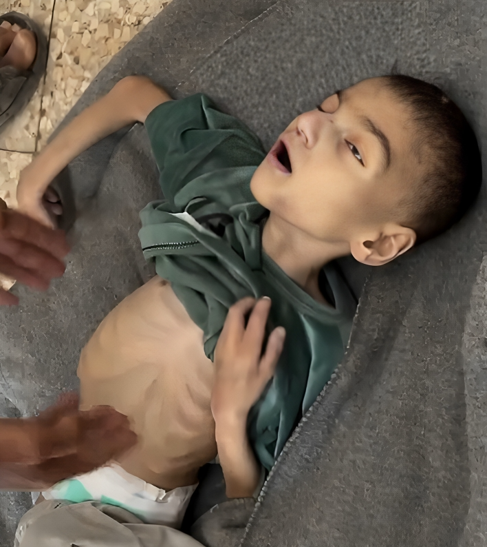 La famine décède un enfant Palestinien à Gaza, portant le total à 40