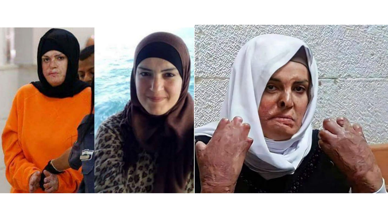 La prisonnière blessée, Israa Jaabees commence une nouvelle année derrière les barreaux israéliens