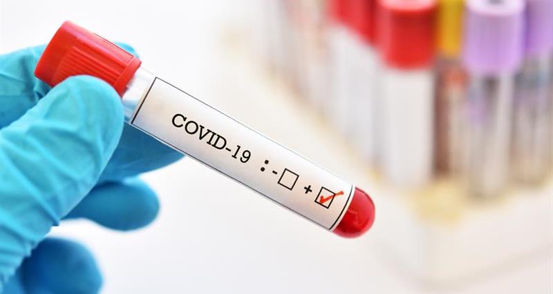 16 décès et 2536 nouveaux cas de Coronavirus en Palestine