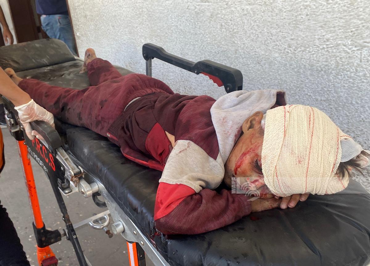 Des martyrs et des blessés dans un bombardement de l'occupation sur les camps de réfugiés de Al-Bureij et Al-Nuseirat