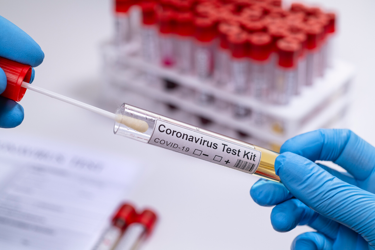 5 décès et 726 nouveaux cas de Coronavirus en Palestine